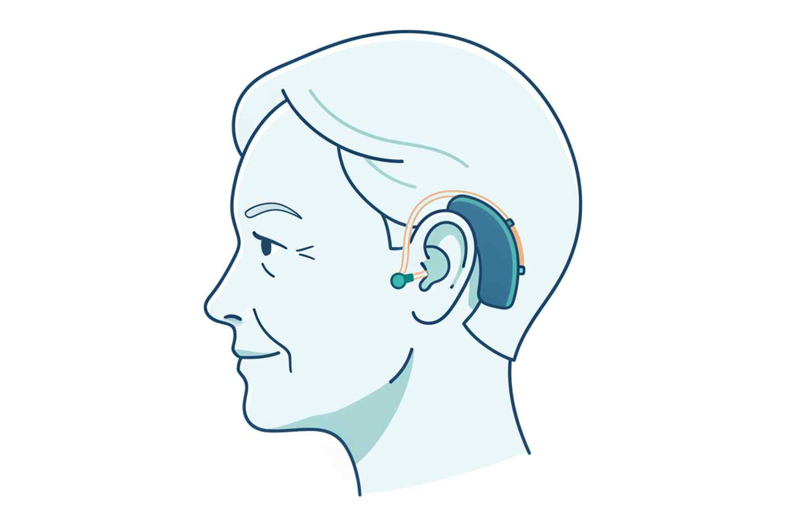 Senior wearing hearing aid medical illustration