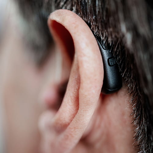Widex Allure AI RIC R D showing its sleek, discreet design