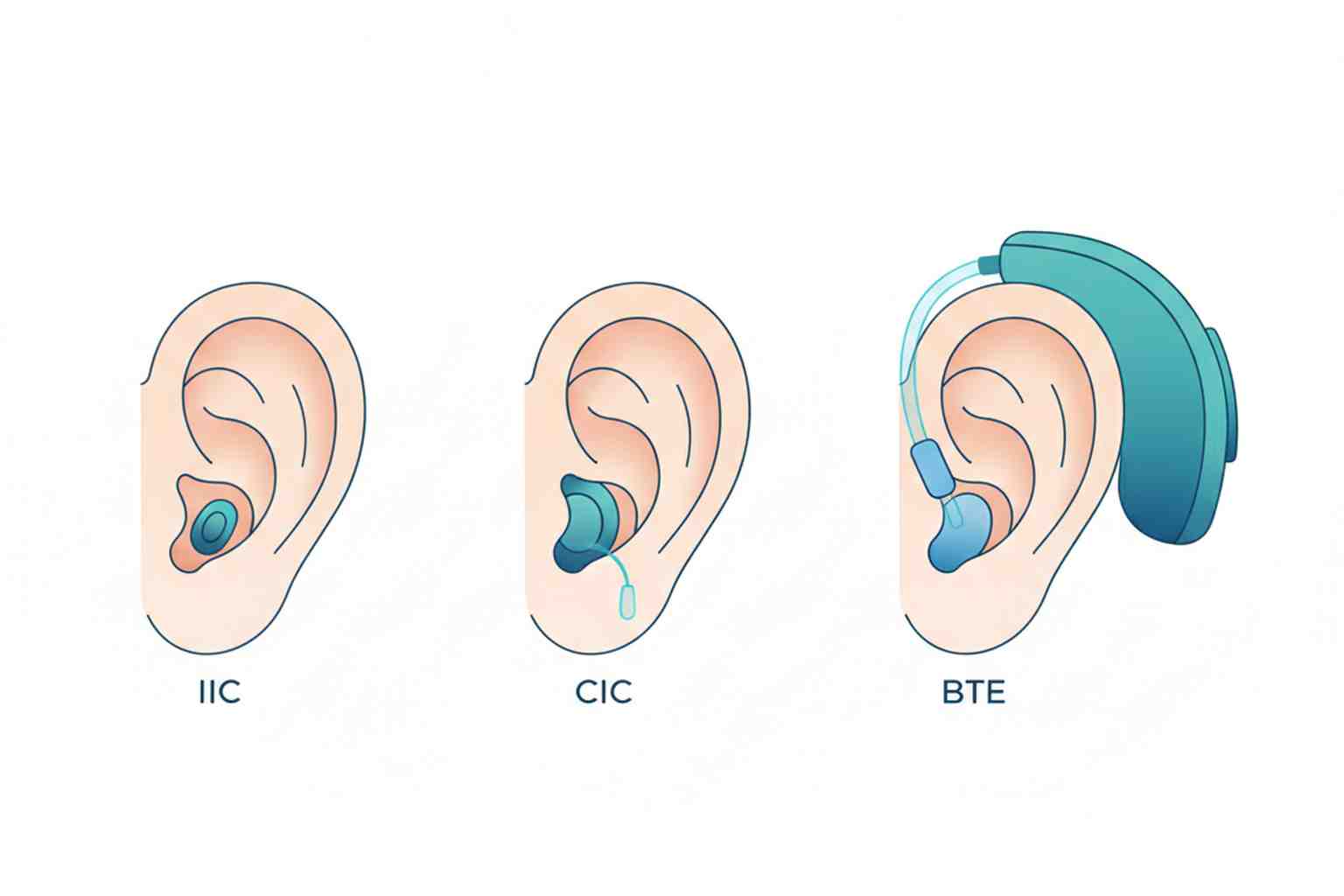 Medical illustration comparing IIC, CIC, and BTE hearing aid styles