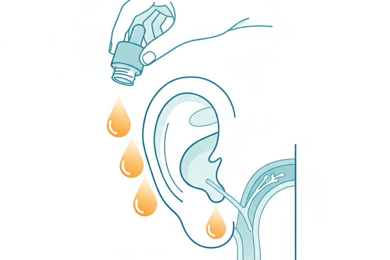 Warm oil drops being placed into an ear canal