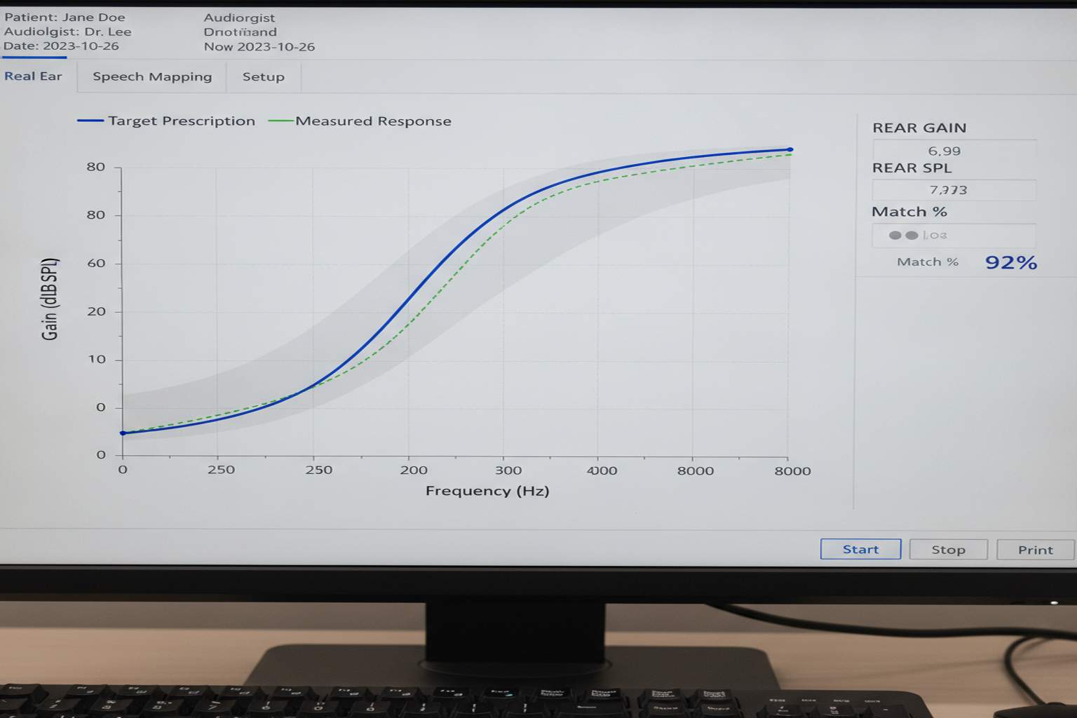 Real ear measurement frequency response curves on a computer screen